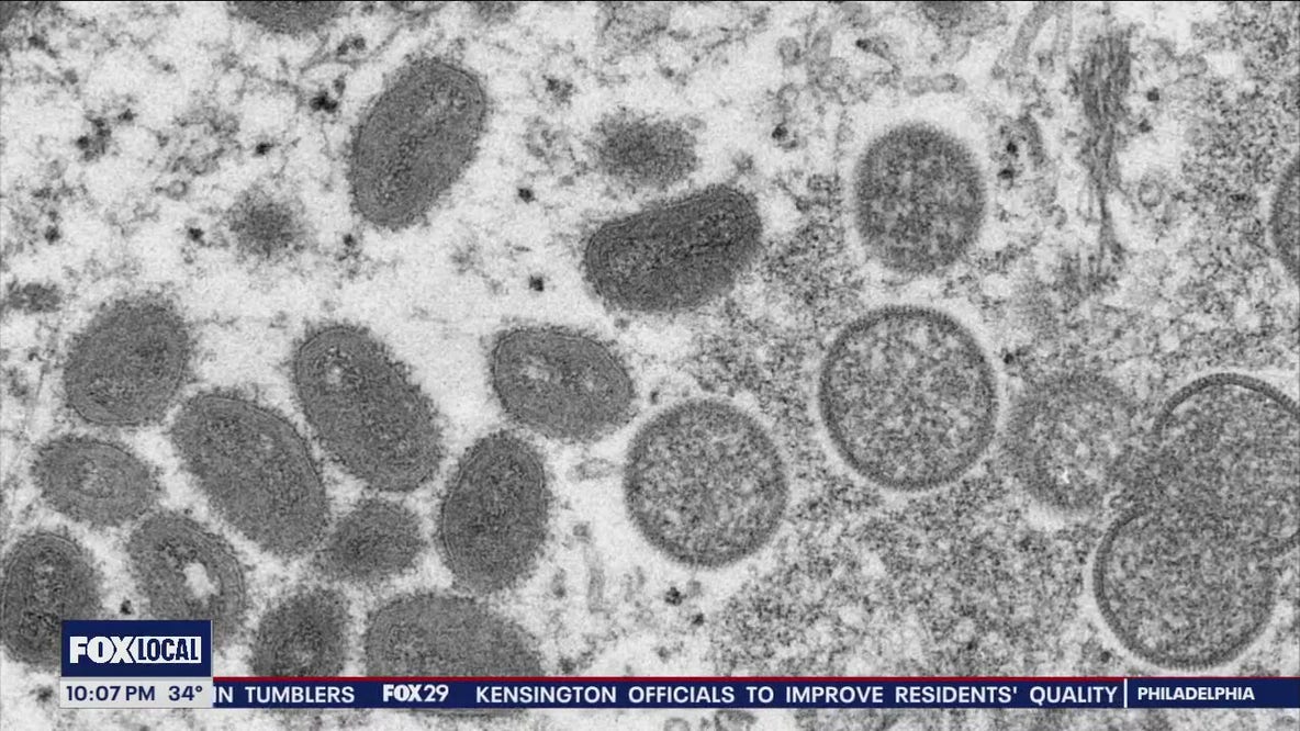 What is Mpox? Potential monkey pox exposure at school in Port Richmond